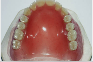 dentallabor-prothesen-goettingen