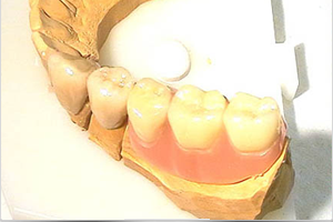 dentallabor-teilprothesen-goettingen