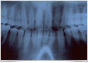 flickr_oralchirurgie-goettingen
