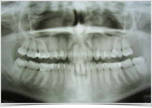 oralchirurgie-mundchirurg-goettingen