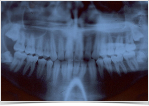 oralchirurgie-oralchirurg-goettingen