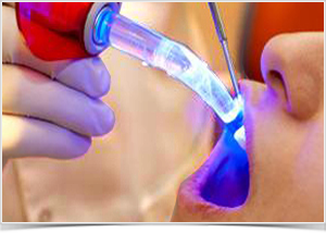 parodontose-laserbehandlung-goettingen